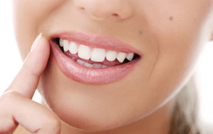 Cosmetic Dentistry Boynton Beach