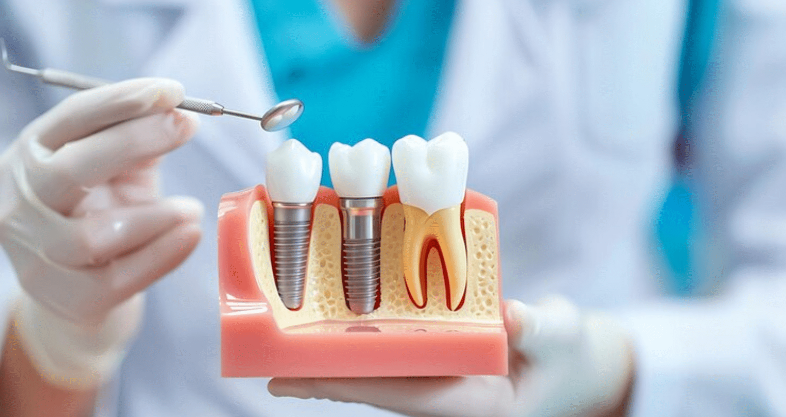 how long does it take to recover from dental implant surgery